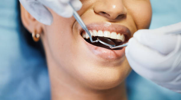 Best Chipped Tooth Repair Near Me  in Valley Cottage, NY