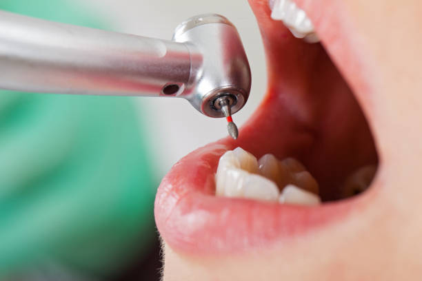 Best Cracked Tooth Emergency Dentist  in Valley Cottage, NY